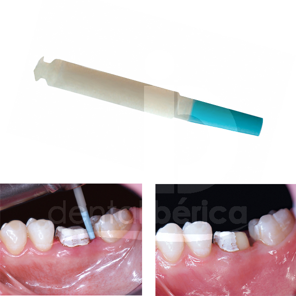 Opticlean ciments kerr