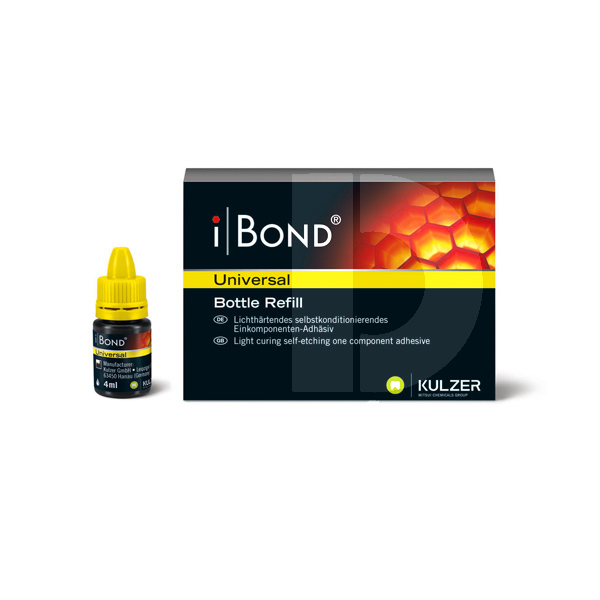 Ibond universal recharge restauration kulzer