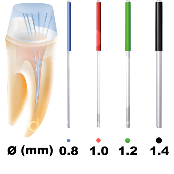 Rebilda post gt nº12 ø 0,8 mm. tenons et reconstitution coronaire voco