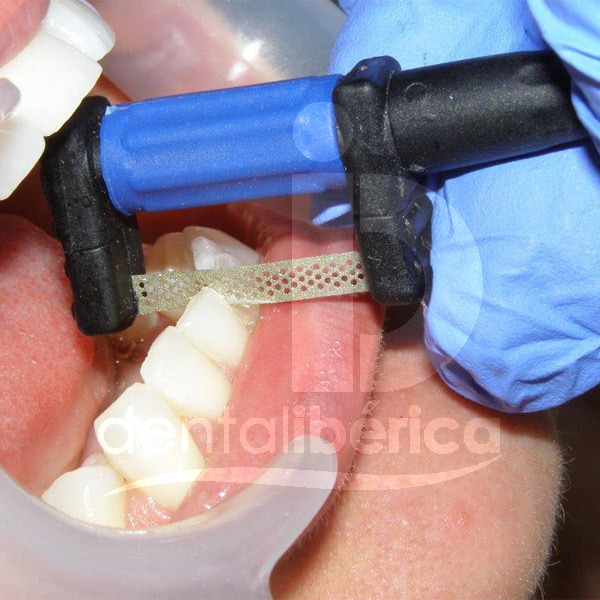 Manche pour sunset strip instruments garrison